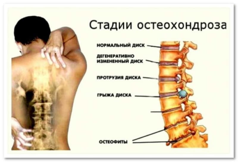 Гимнастика Бутримова от головных болей при сидячей работе (видео)