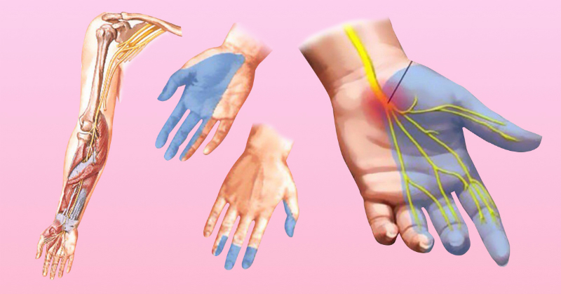 Почему немеют руки: 7 причин, заставляющих задуматься о здоровье.