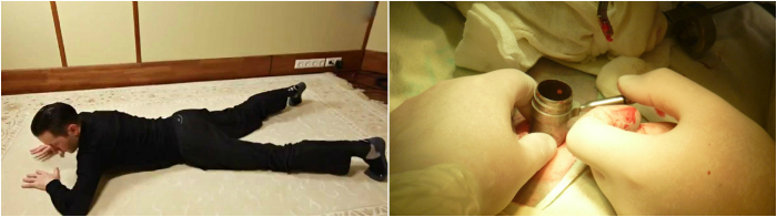 Лечение межпозвоночной грыжи без лекарств и операции: упражнения для спины от Шамиля Аляутдинова.