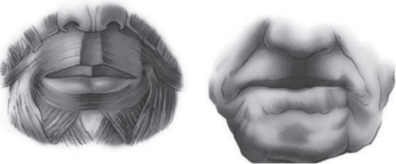Круговая мышца рта: Избавляемся от складок и обвислости