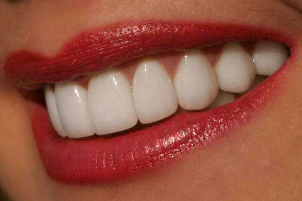 Безопасные способы отбеливания зубов в домашних условиях