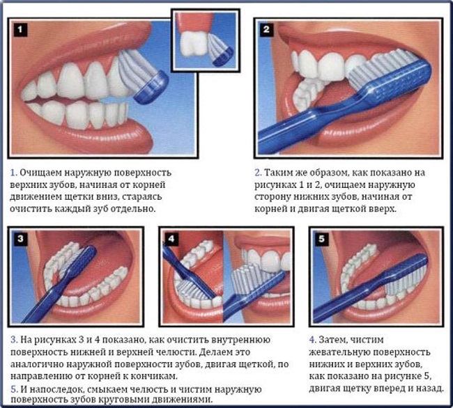 Отбеливать зубы в домашних условиях — легко! Народные способы, как избавиться от желтизны эмали.