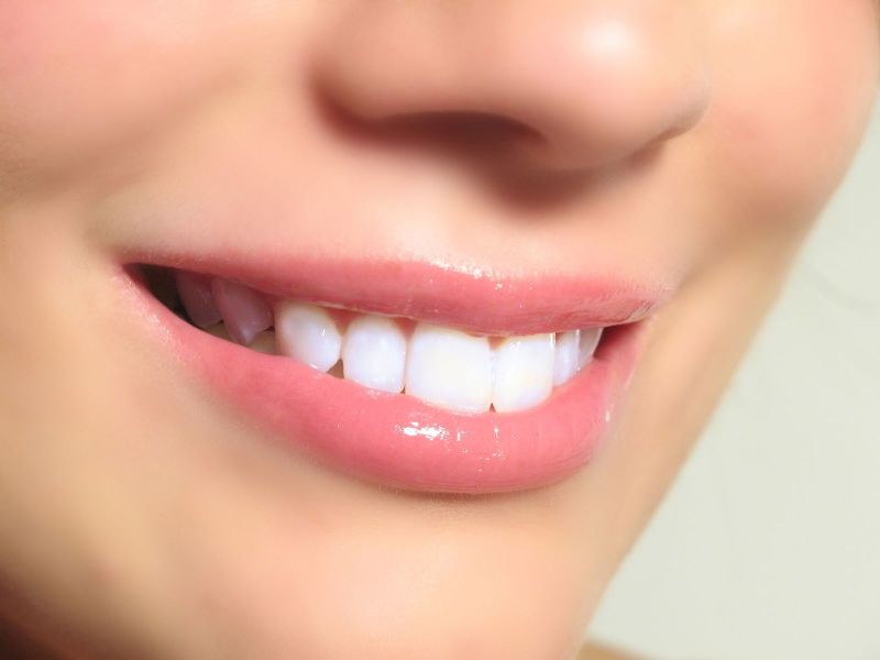 Улыбка на миллион: как отбелить зубы в домашних условиях за 3 минуты.