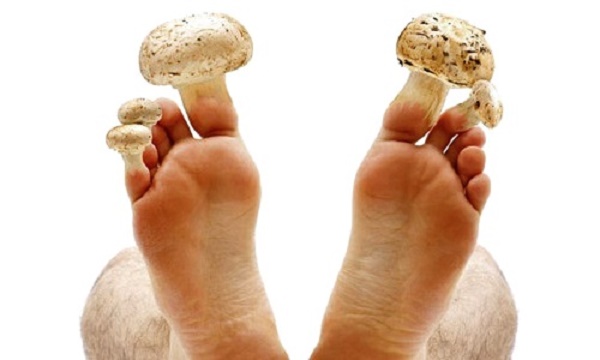 Всего два ингредиента помогут вам забыть о грибке ногтей!