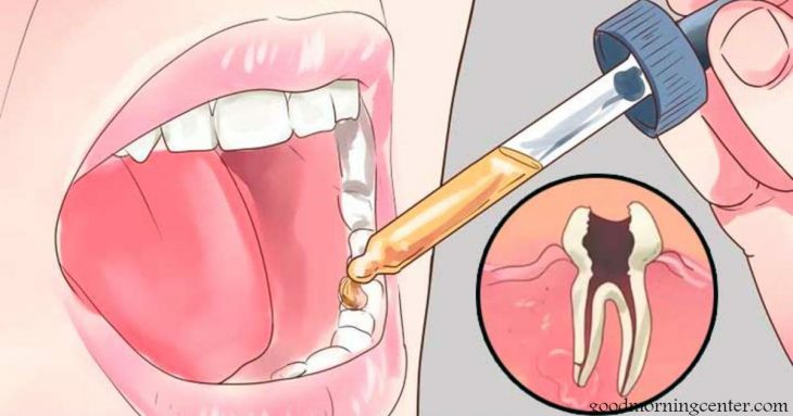 Мы расскажем вам, как снять любую зубную боль всего за пару секунд!