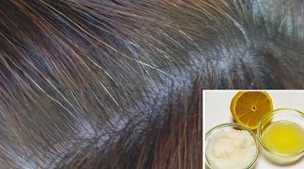 Кокосовое масло и лимон: лучшее средство от седых волос!