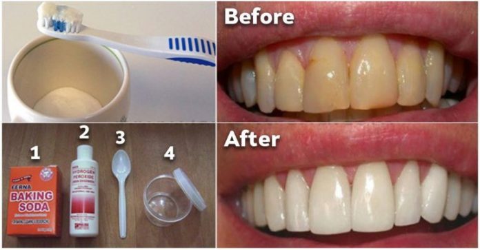 Как избавиться от зубного налета и отбеливать зубы без дорогостоящих процедур. Вам понравится это средство!